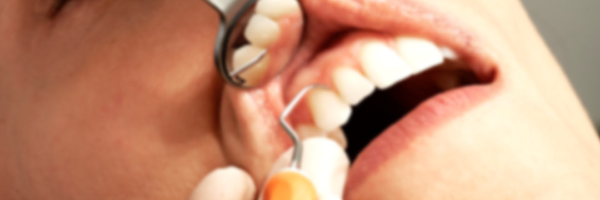 Sonrisa sana — tratamientos dentales en Clínica Dental Estudio 32