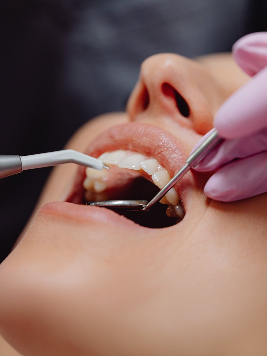 Tratamiento de estética dental en Clínica Dental Estudio 32, Telde